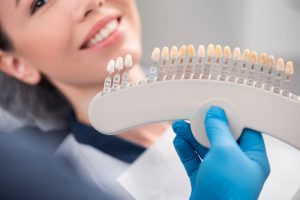 Veneers in Burlington, ON